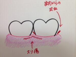 20160102